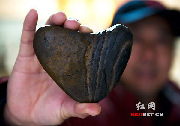 JDB电子游戏官网-滴虫性阴道炎后要做什么检查