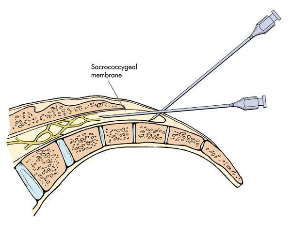 德国杯-比达尔传射莱万格策建功 拜仁3-1业余队_JDB电子试玩网页版